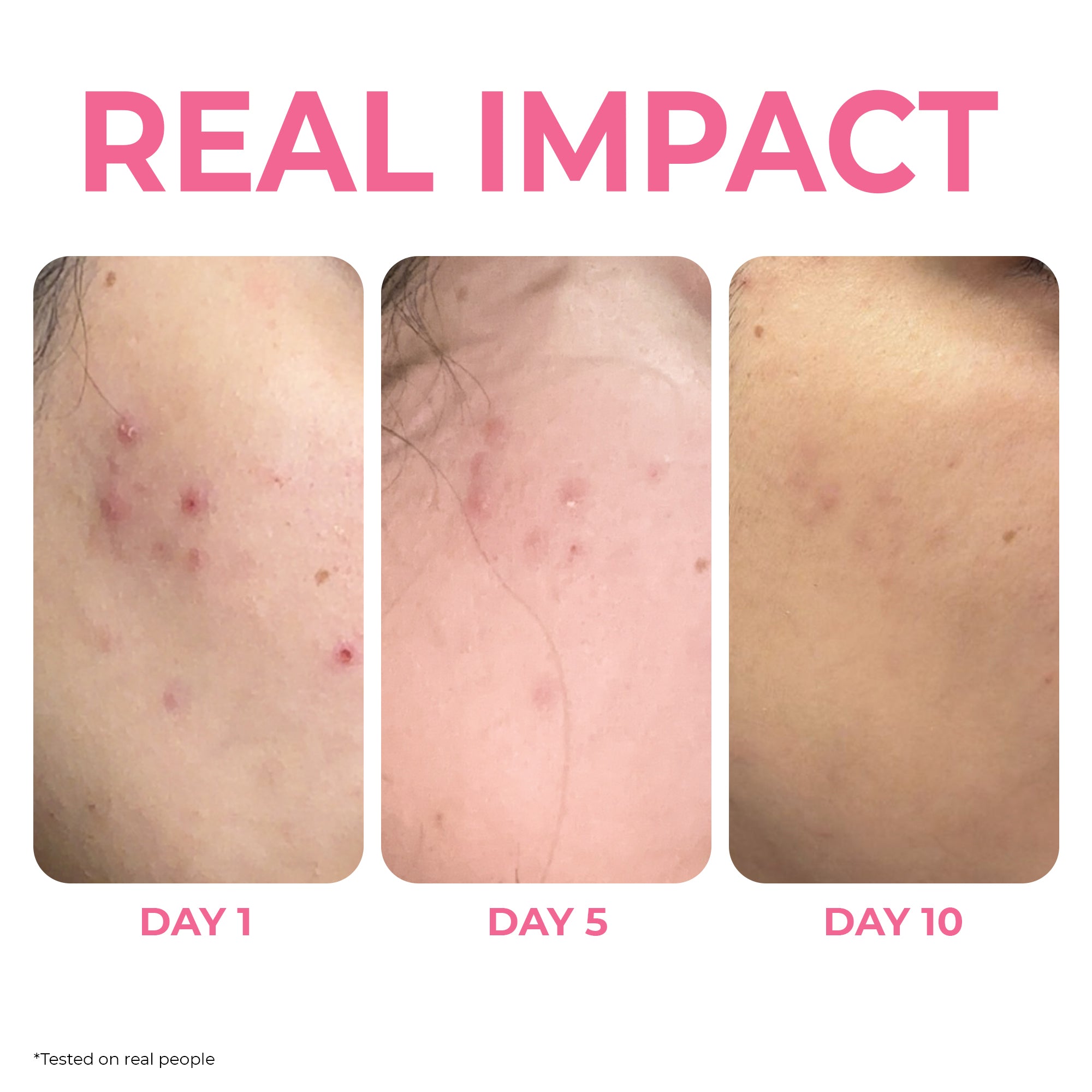 Skin Tonic Face Serum -  Enriched with 5% Niacinamide and 2% Alpha Arbutin